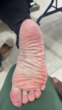 SoleShopping - Size 7 dry wrinkled mature white queen
